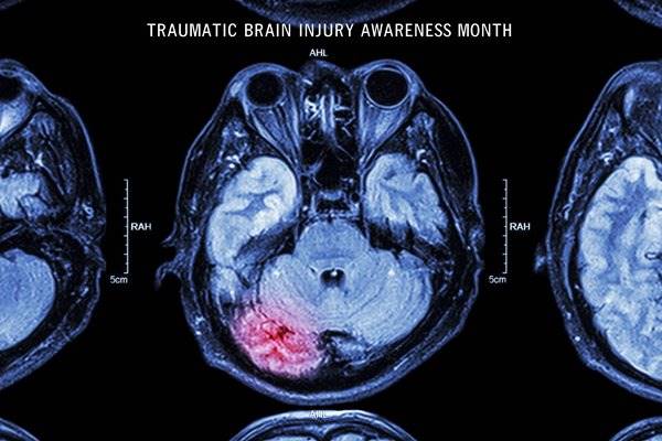 March is Traumatic Brain Injury Month