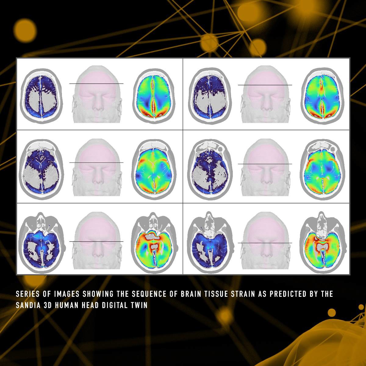 Image of a brain tissue scan